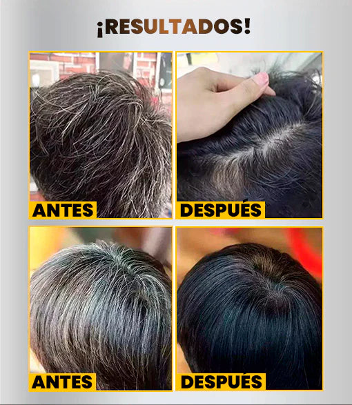 Shampoo Cubre Canas 400ML Dr. Rashel🧴✨